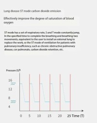 Special ventilator for lung disease